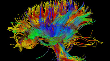 Brainfood: Nootropics